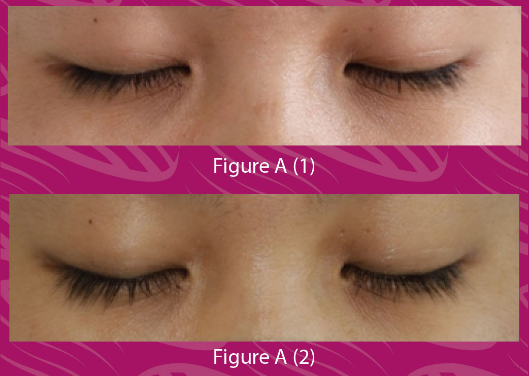 Eyelash Restorative Serum Case Studies